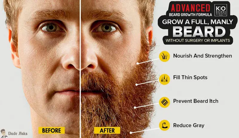 beard growth formula